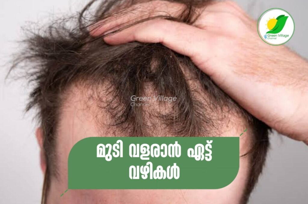 മുടി വളരാൻ ഏട്ട് വഴികൾ | Eight ways to growth of hair IMG 20230901 WA0006 1024x680