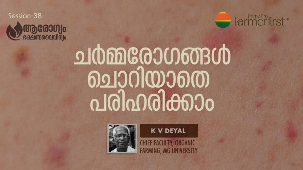 ചർമ്മരോഗങ്ങൾ ചൊറിയാതെ പരിഹരിക്കാം kv dayal