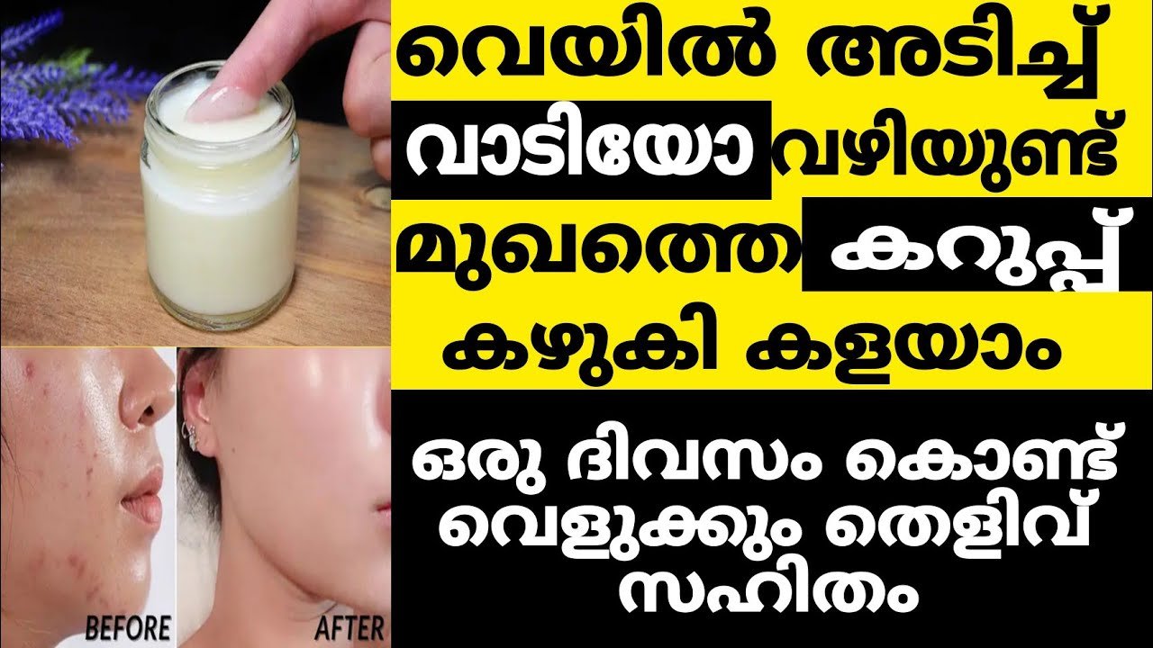 മുഖത്തെ കറുപ്പ് ഇനി വളരെ വേഗത്തിൽ മാറ്റാം..!! ഒരു ദിവസം കൊണ്ട് ഇനി വെളുക്കും..|kattanchaya facepack remady